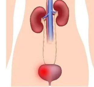 The reasons for the development of cystic in women