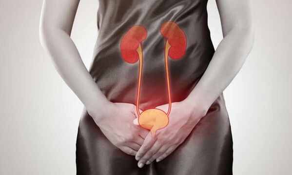 Causes and Treatment of Cystique in Women