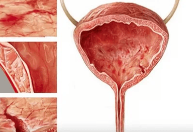 The reasons for the development of cystic in women